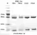 Fig. 04 - METHOD OF MEASURING CHOLESTEROL LEVELS BY USING IMMUNOGENIC METHOD