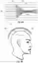 Fig. 06 - Magnetic field shaping components for magnetic field measurement systems and methods for making and using