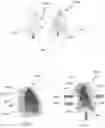 Fig. 09 - Deformable dosimeter