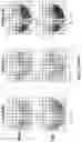 Fig. 06 - Progressive optical designs for different add powers