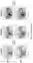 Fig. 07 - Progressive optical designs for different add powers