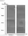 Fig. 04 - PROCESS FOR IMPROVING THE CRITICAL DIMENSION UNIFORMITY OF ORDERED FILMS OF BLOCK COPOLYMERS