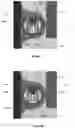 Fig. 11 - Mask assembly