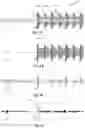 Fig. 05 - Systems and methods for selecting an audio track by performing a gesture on a track-list image