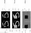 Fig. 10 - System and method for noise-based training of a prediction model