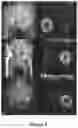 Fig. 04 - Method and system of analyzing medical images
