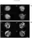 Fig. 12 - Live-cell computed tomography