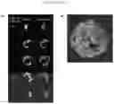 Fig. 14 - Live-cell computed tomography