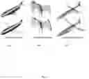 Fig. 09 - System and method for generating planar section 3D shape representations