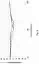Fig. 06 - Active noise-cancelling headphones