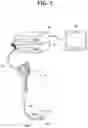 Fig. 02 - Endoscope and image pickup module