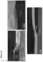Fig. 05 - Lateral heterojunctions between a first layer and a second layer of transition metal dichalcogenide