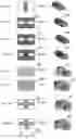 Fig. 08 - Trenched bottom electrode and liftoff based molecular devices