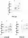 Fig. 04 - ESD PROTECTION CIRCUIT WITH REDUCED PARASITE CAPACITANCE AND METHOD FOR REDUCING ESD PARASITE CAPACITANCE
