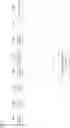 Fig. 04 - Systems and methods for adaption of a telephonic audio signal