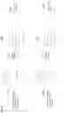 Fig. 16 - Systems and methods for adaption of a telephonic audio signal