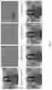 Fig. 02 - DEPENDENT RANDOM ACCESS POINT PICTURES
