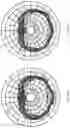 Fig. 11 - Playback devices having waveguides