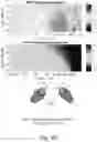 Fig. 04 - Methods and systems for determining and/or using an audio filter based on head-tracking data