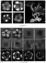 Fig. 06 - Petunia plants having a spotted flower color pattern