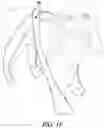 Fig. 11 - STRETCHABLE ANIMAL FOOT COVERING