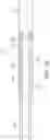 Fig. 23 - INHALATION DEVICE AND COMPONENT FOR AN INHALATION DEVICE