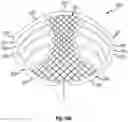 Fig. 14 - Brassiere and associated method of manufacture