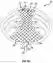 Fig. 15 - Brassiere and associated method of manufacture