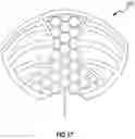 Fig. 16 - Brassiere and associated method of manufacture