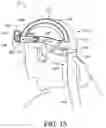 Fig. 17 - Personal protection and ventilation system