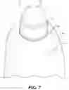 Fig. 08 - Protective glove
