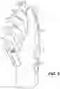 Fig. 10 - Protective glove