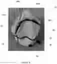 Fig. 05 - Swim cap