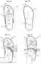 Fig. 02 - FLIP FLOP AND SLIPPER IN ONE/CONVERTIBLE SANDAL SLIPPER