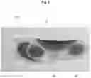 Fig. 03 - INSOLE