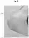 Fig. 05 - INSOLE