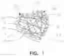 Fig. 02 - STRINGED JEWELRY