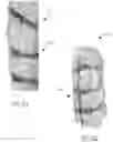 Fig. 26 - Load carriage frame