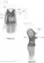 Fig. 16 - CHILD-SUPPORTING HARNESS