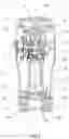 Fig. 05 - Bean grinding apparatus