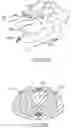 Fig. 23 - APPARATUS AND METHOD FOR FOUR DIMENSIONAL SOFT TISSUE NAVIGATION