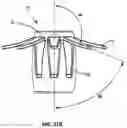 Fig. 41 - Fitting For A Medical Scoping Device Having A Plurality of Protuberances And Tab