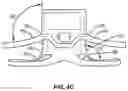 Fig. 06 - Fitting For A Medical Scoping Device Having A Plurality of Protuberances
