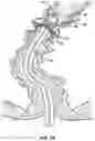 Fig. 33 - Fitting For A Medical Scoping Device Having A Plurality of Protuberances