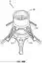 Fig. 35 - Fitting For A Medical Scoping Device Having A Plurality of Protuberances