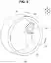 Fig. 04 - Hood for endoscope and endoscope system