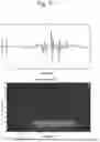 Fig. 40 - AUTOMATED DETECTION OF BRAIN DISORDERS