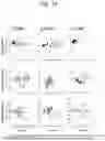 Fig. 41 - AUTOMATED DETECTION OF BRAIN DISORDERS