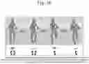 Fig. 43 - AUTOMATED DETECTION OF BRAIN DISORDERS