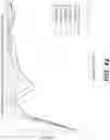 Fig. 49 - AUTOMATED DETECTION OF BRAIN DISORDERS
